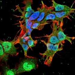 Stargazin Antibody (S245-36), Novus Biologicals 0.1mg; Unlabeled:Antibodies,